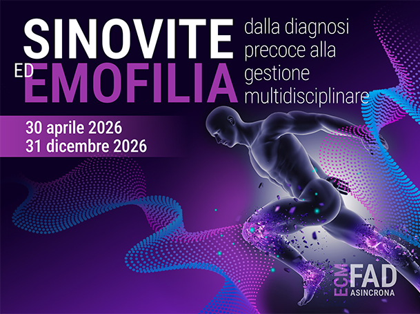 Sinovite ed Emofilia